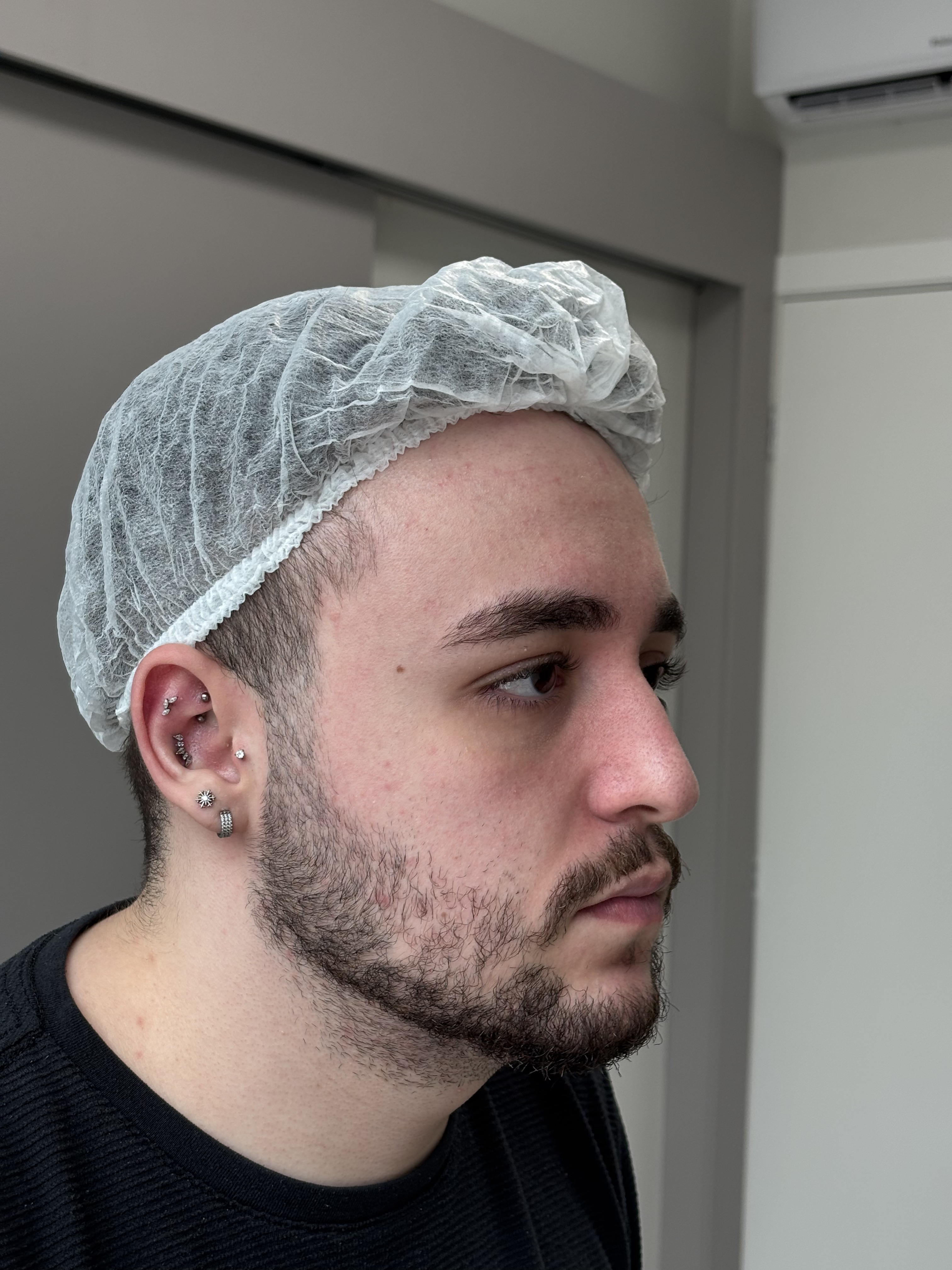 Antes do procedimento