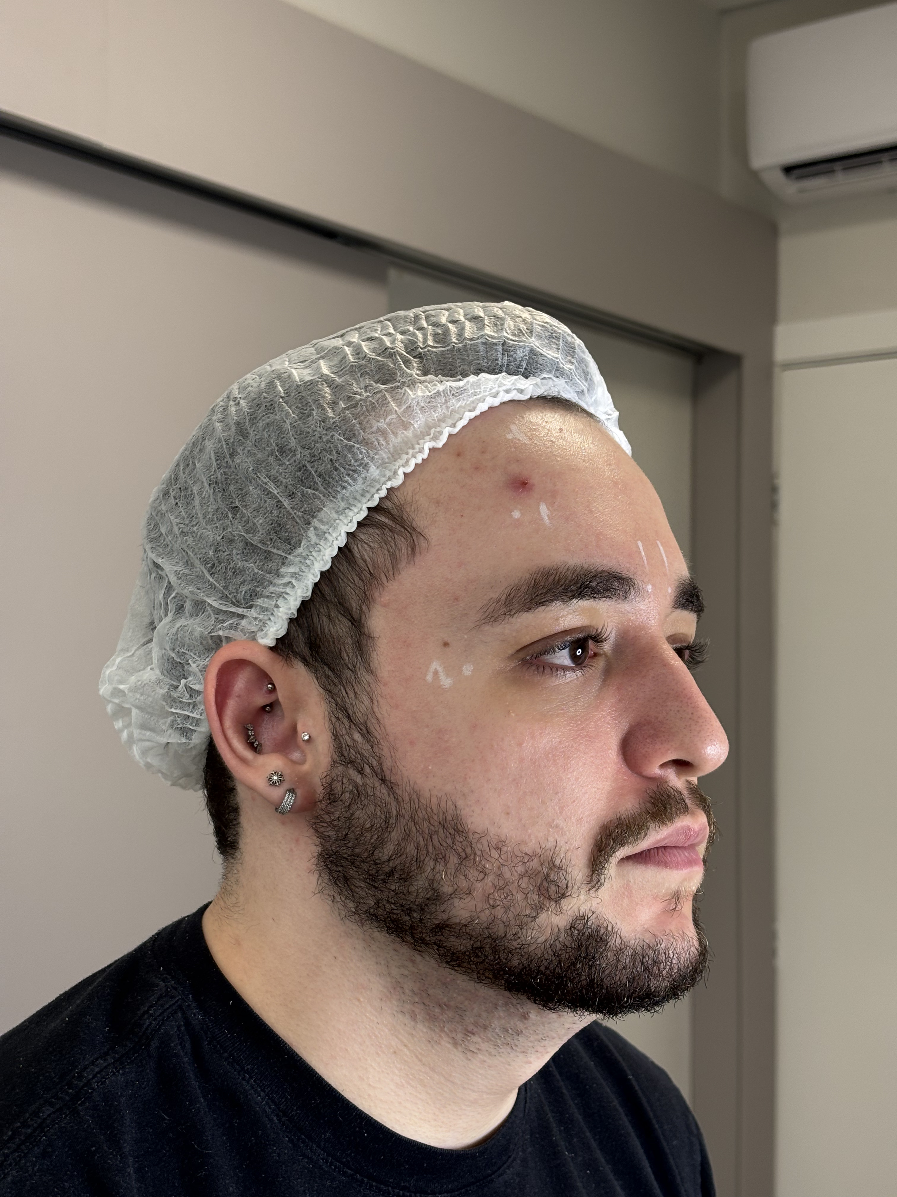 Resultado após procedimento